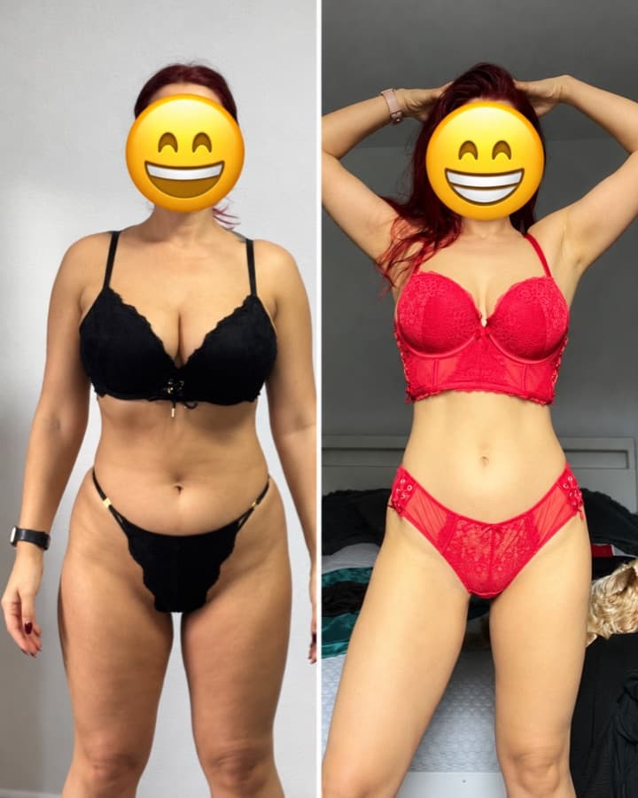 Magda before and after losing 11 kg