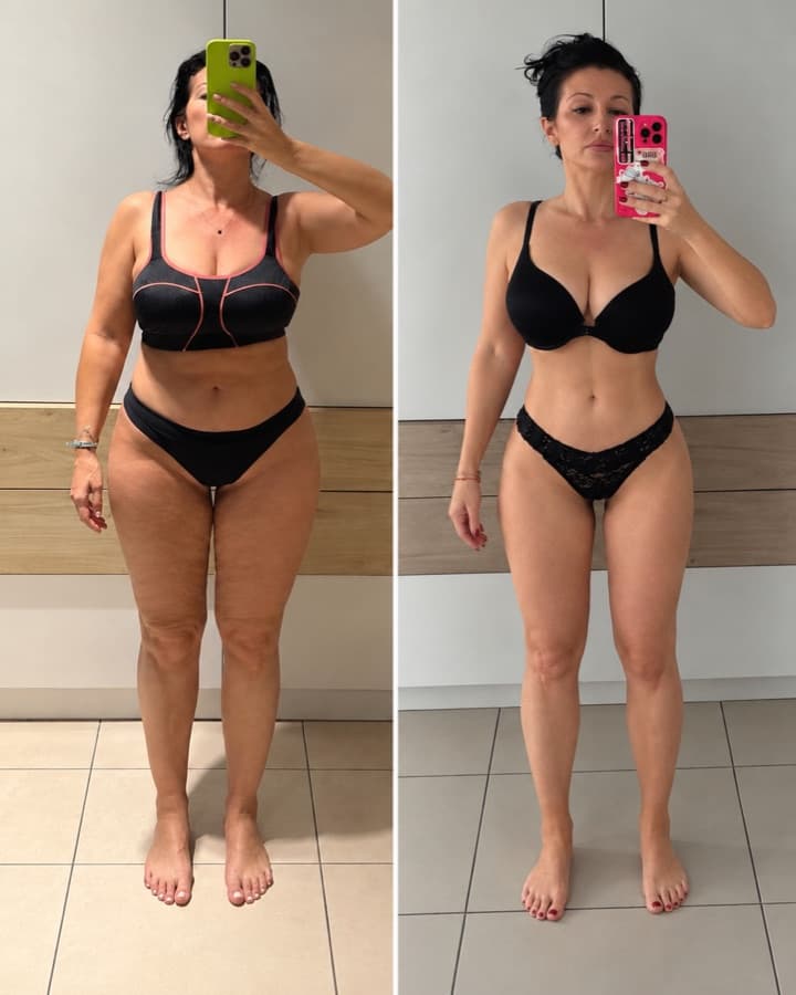 Maria before and after losing 13 kg