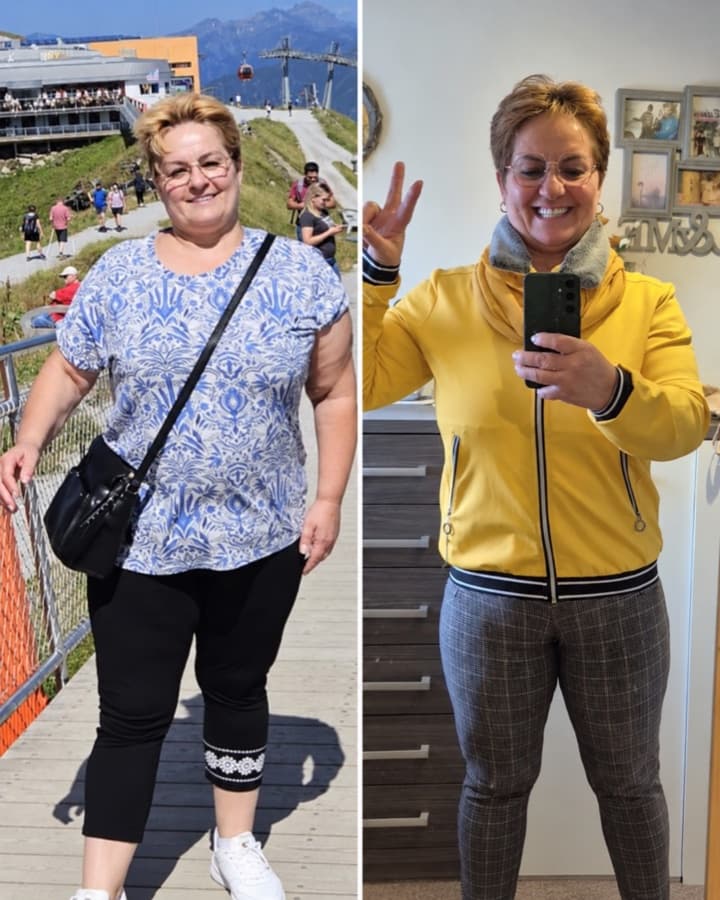 Client before and after losing 23 kg